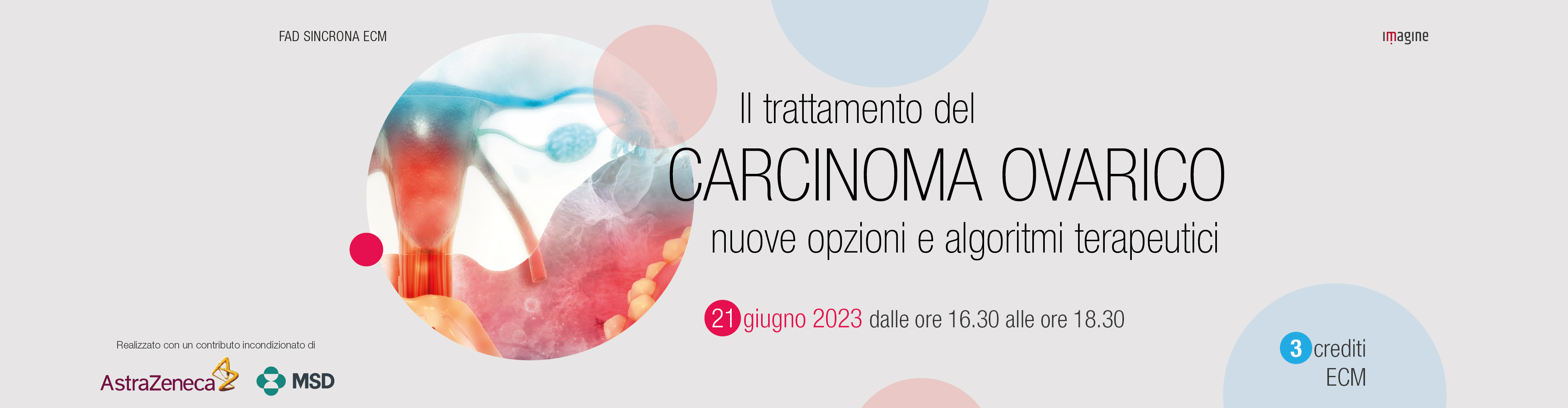 Il trattamento del carcinoma ovarico: nuove opzioni e algoritmi terapeutici